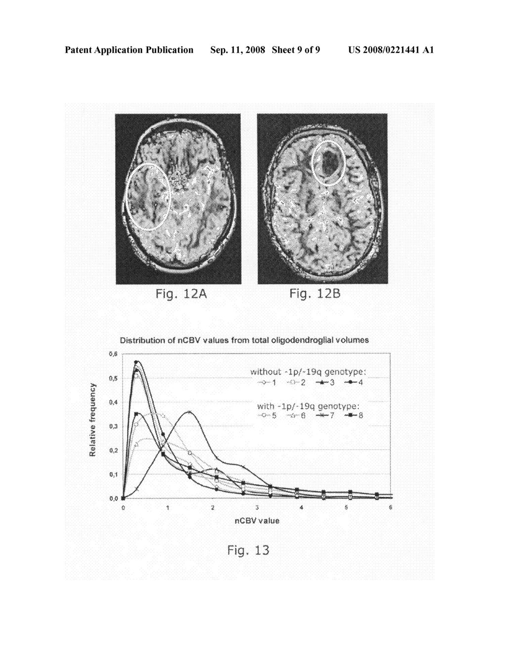 Tumor grading from blood volume maps - diagram, schematic, and image 10