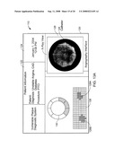 NEAR-INFRARED SPECTROSCOPIC ANALYSIS OF BLOOD VESSEL WALLS diagram and image