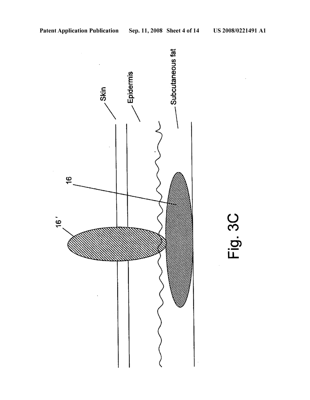 METHOD AND SYSTEM FOR COMBINED ENERGY THERAPY PROFILE - diagram, schematic, and image 05