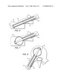 Expandable Blade Device for Stabilizing Compression Fractures diagram and image