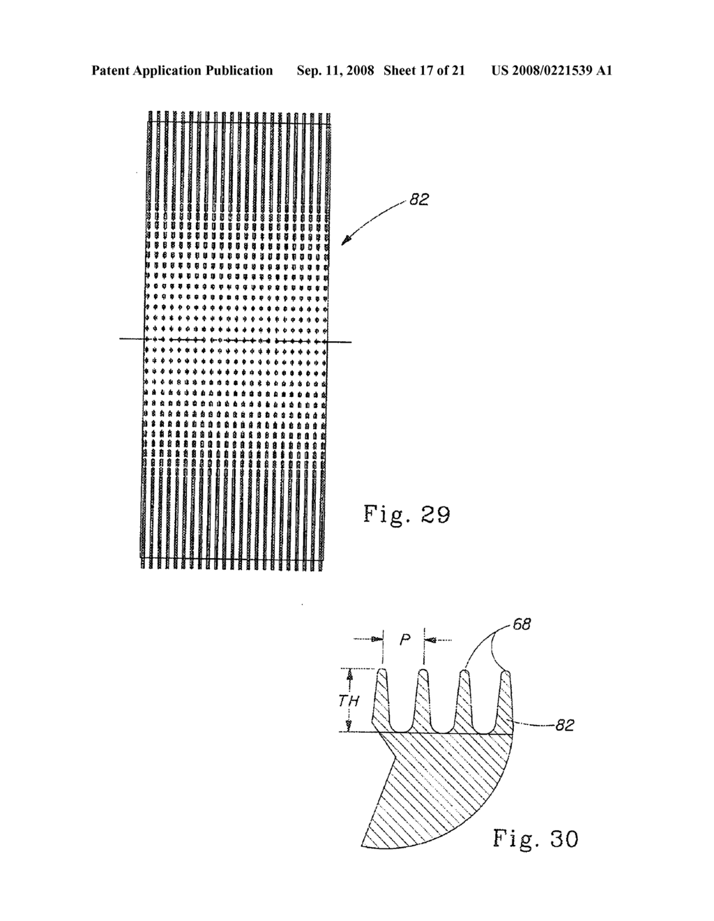 Absorbent core for disposable absorbent article - diagram, schematic, and image 18