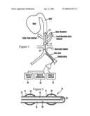 System and method for rapidly cooling cardiac arrest patient diagram and image