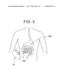 METHOD FOR WIRELESSLY MONITORING IMPLANTED MEDICAL DEVICE diagram and image