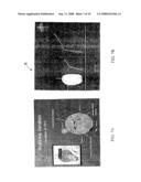 Method and apparatus for detecting and achieving closure of patent foramen ovale diagram and image