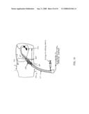 Method and apparatus for detecting and achieving closure of patent foramen ovale diagram and image