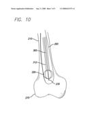 EXPANDABLE BLADE DEVICE FOR STABILIZING LONG BONE FRACTURES diagram and image