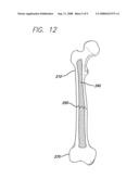 EXPANDABLE BLADE DEVICE FOR STABILIZING LONG BONE FRACTURES diagram and image