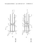 EMBOLIC PROTECTION DEVICE HAVING EXPANDABLE TRAP diagram and image