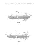 EMBOLIC PROTECTION DEVICE HAVING EXPANDABLE TRAP diagram and image