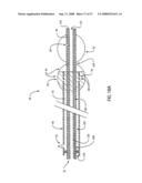 EMBOLIC PROTECTION DEVICE HAVING EXPANDABLE TRAP diagram and image