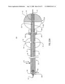 EMBOLIC PROTECTION DEVICE HAVING EXPANDABLE TRAP diagram and image