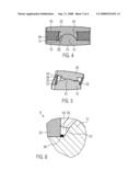 INTERVERTEBRAL PROSTHESIS diagram and image