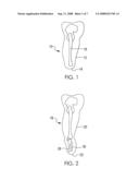 VACUUM ASSISTED PROSTHETIC SLEEVE AND SOCKET diagram and image