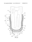 VACUUM ASSISTED PROSTHETIC SLEEVE AND SOCKET diagram and image