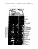 Expression Profile Of Prostate Cancer diagram and image