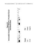 Expression Profile Of Prostate Cancer diagram and image