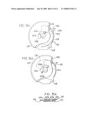 Inhalation Device diagram and image