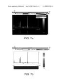 System and method for displaying medical imaging spectral data as hypsometric maps diagram and image