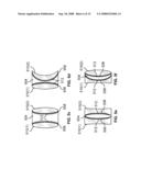 MOTIONLESS LENS SYSTEMS AND METHODS diagram and image