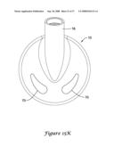 Earbud Adapter with Enhanced Frequency Response diagram and image