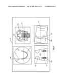 X-ray CT imaging displaying method, X-ray CT image displaying apparatus, and X-ray CT apparatus diagram and image