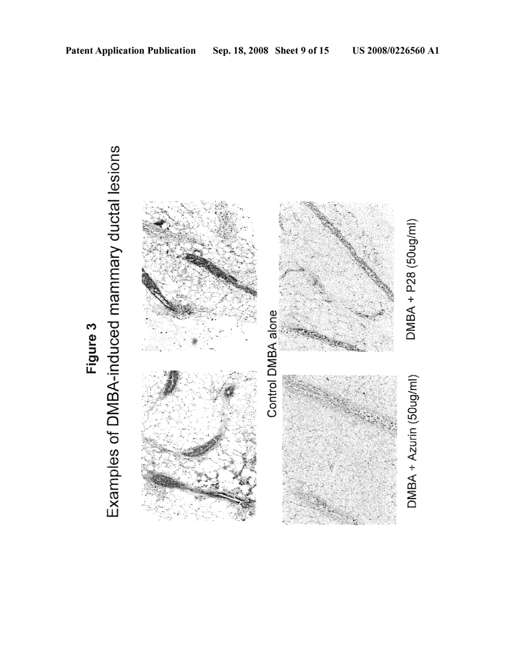 COMPOSITIONS AND METHODS TO PREVENT CANCER WITH CUPREDOXINS - diagram, schematic, and image 10