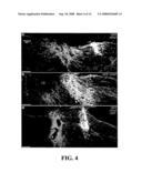 Transplantation of Glial Restricted Precursor-Derived Astrocytes for Promotion of Axon Growth diagram and image