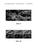 Transplantation of Glial Restricted Precursor-Derived Astrocytes for Promotion of Axon Growth diagram and image