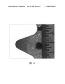 Wear resistant ceramic coated aluminum alloy article and method for making same diagram and image