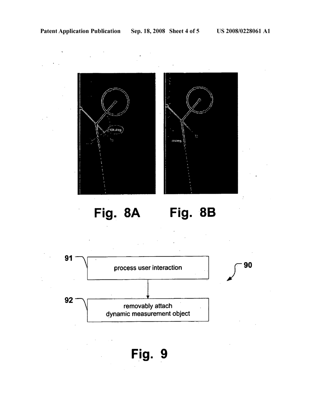 Method and Apparatus Providing Flexible Measurement Functionality for Medical Images - diagram, schematic, and image 05