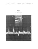 ULTRASOUND DIAGNOSTIC SYSTEM AND METHOD FOR DISPLAYING A DOPPLER SPECTRUM IMAGE diagram and image