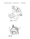 SINUS ILLUMINATION LIGHTWIRE DEVICE diagram and image