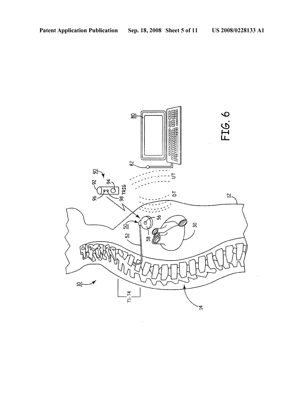 DELIVERY OF A SYMPATHOLYTIC CARDIOVASCULAR AGENT TO THE CENTRAL NERVOUS SYSTEM - diagram, schematic, and image 06