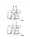 SYSTEM AND METHOD FOR MINIMALLY INVASIVE SPINAL SURGERY diagram and image