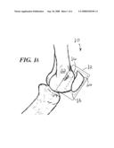 IN SITU PATELLAR FIXING SYSTEM diagram and image