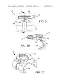 IN SITU PATELLAR FIXING SYSTEM diagram and image