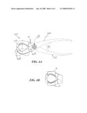 IN SITU PATELLAR FIXING SYSTEM diagram and image