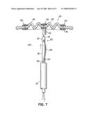 SUTURE CUTTER AND METHOD OF CUTTING SUTURE diagram and image