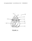 INTRALUMENAL MATERIAL REMOVAL USING A CUTTING DEVICE FOR DIFFERENTIAL CUTTING diagram and image