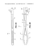 Interlaminar-Interspinous Vertebral Stabilization System diagram and image