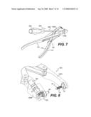 Interlaminar-Interspinous Vertebral Stabilization System diagram and image