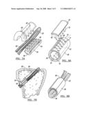 Method and apparatus for graft fixation diagram and image