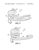 Composite Prosthetic Foot diagram and image