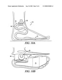 Composite Prosthetic Foot diagram and image