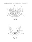 DIRECT MANUFACTURE OF DENTAL AND MEDICAL DEVICES diagram and image