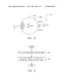 Eye module diagram and image