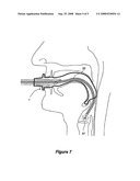 Oropharyngeal Airway Device diagram and image