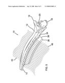 Hair extension clip diagram and image