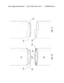 Segmented Sleeve on a Downhole Tool String Component diagram and image