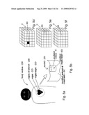 Radioimaging diagram and image